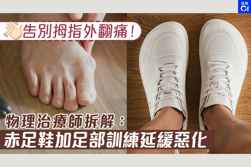 告別拇指外翻痛！物理治療師：赤足鞋加足部訓練延緩惡化